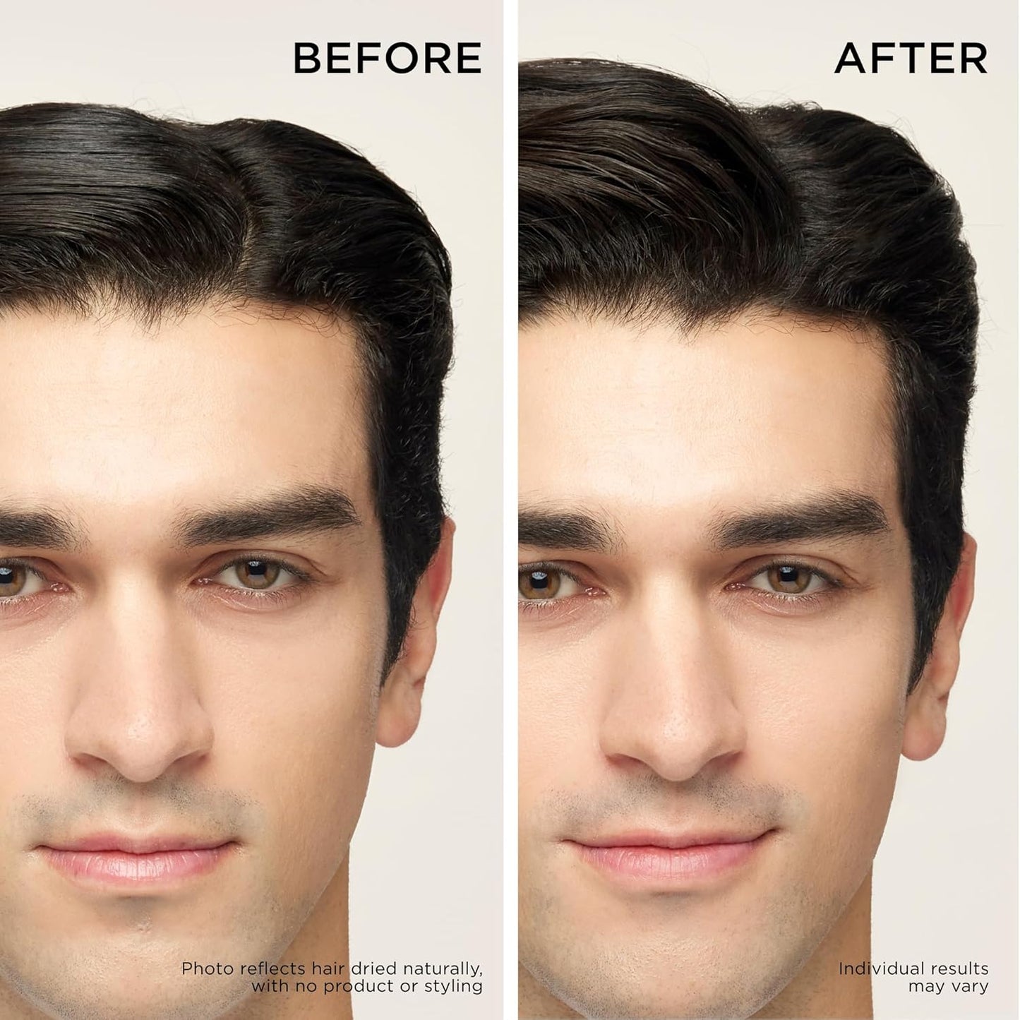 Dr. Groot Thickening Shampoo & Scalp Treatment Set for Hair Loss